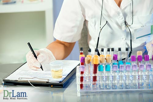 Cbs Test Lab A CBS Mutation May Be Responsible For Your Health Issues