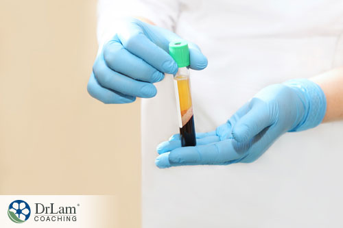 Platelet rich plasma An image of a test tube with platelet rich plasma inside