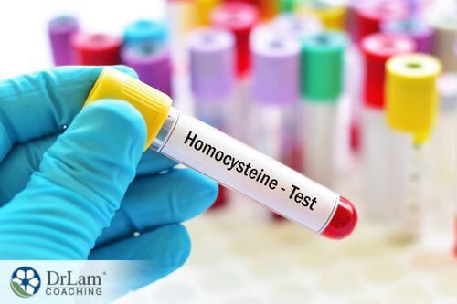 An image of a vile of blood with homocysteine test on it